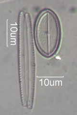 Diatom